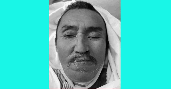 身分不明华裔男死者遗容。