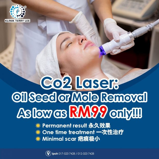 能够消除和减少脸上油粒、痣、痤疮疤痕、大小毛孔和细皱纹的Co2 Laser二氧化碳雷射疗程，只需99令吉！
