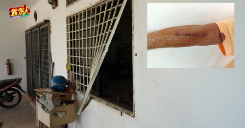 2刀匪破门行劫  抗匪木匠手挂彩