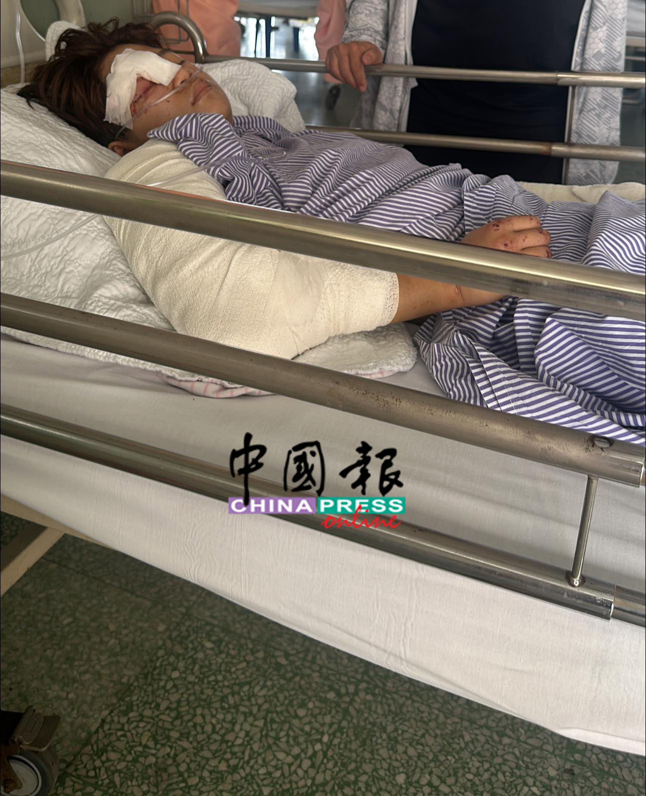 谢幸儿遭撞后一度昏迷,直至13日才逐渐甦醒,然而因局部失忆,她已无法回忆起当晚的车祸经过。