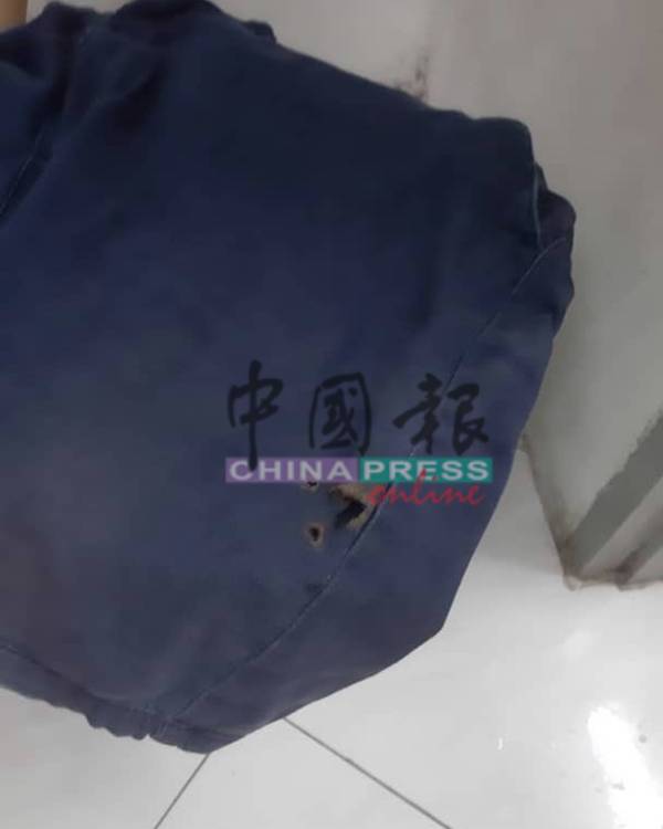廖松城的裤子口袋被烧出几个窟窿,四周还可以闻到糊味。