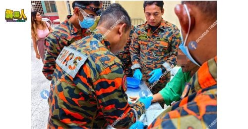 他们身怀十八般武艺  这次帮病患剪断戒指